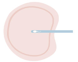 人工授精と体外受精